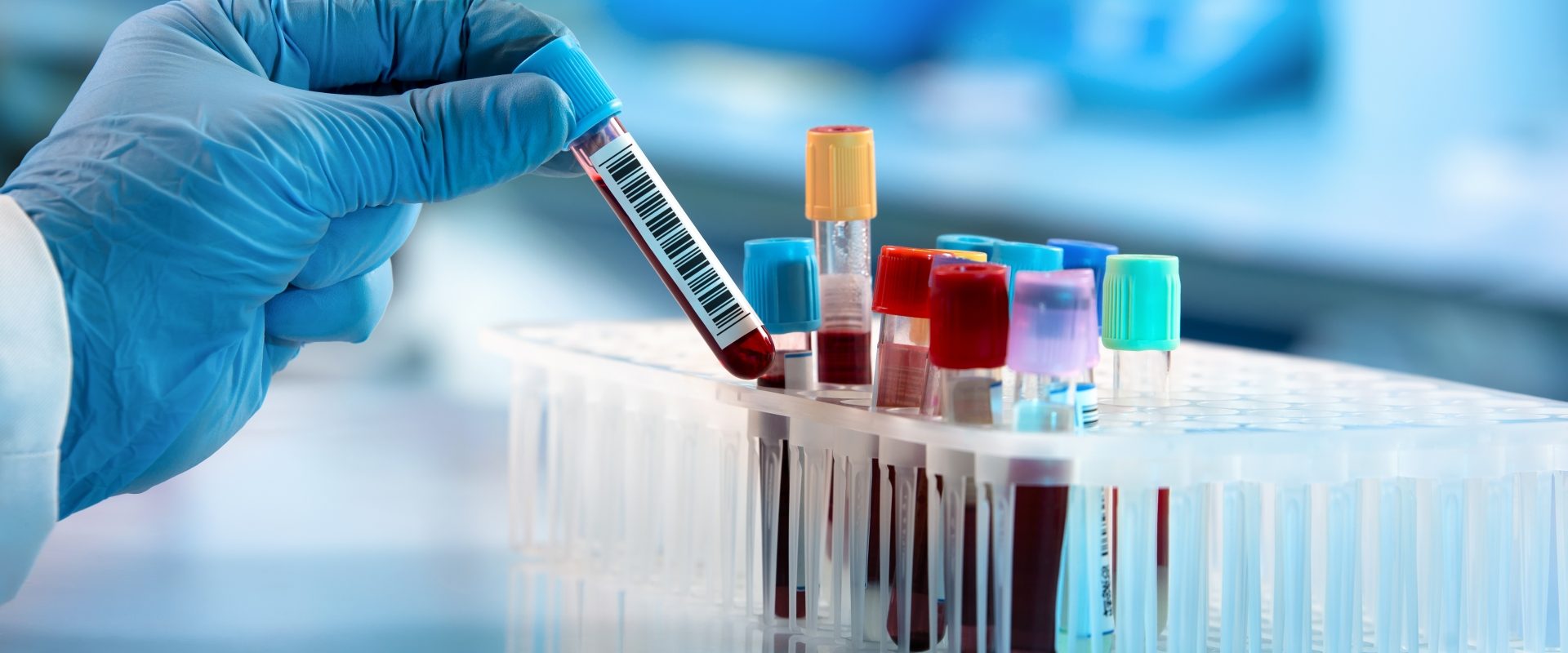 Testy na przeciwciała COVID-19. Diagnosta w laboratorium bada próbki krwi na obecność przeciwciał koronawirusa.