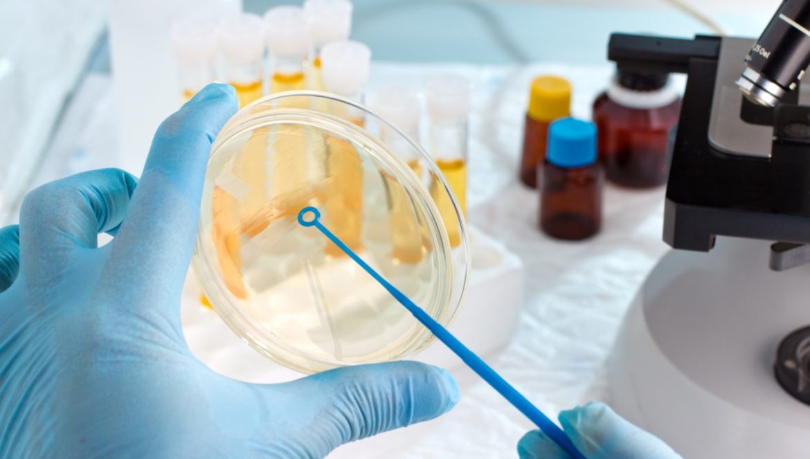 Bakterie w moczu - czy zawsze są groźne i jak je leczyć? Laborant bada próbkę moczu w laboratorium.